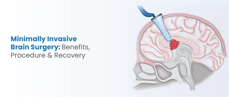 Minimally Invasive Brain Surgery: Benefits, Procedure & Recovery